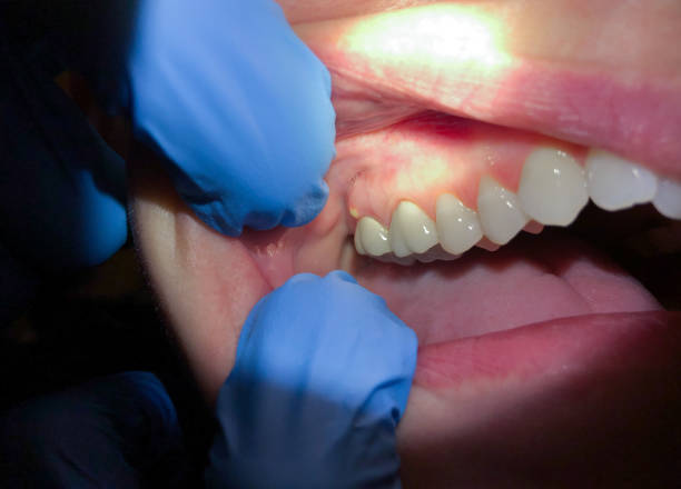 Best Walk-In Emergency Dentist in Angwin, CA